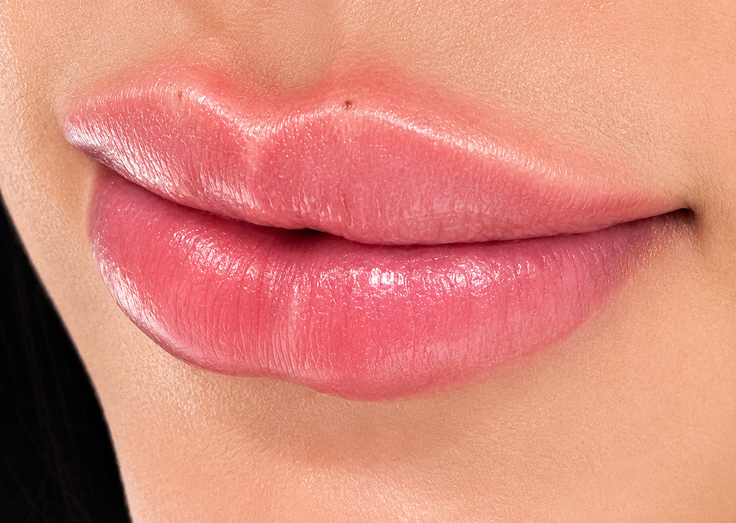 Preenchimento Labial